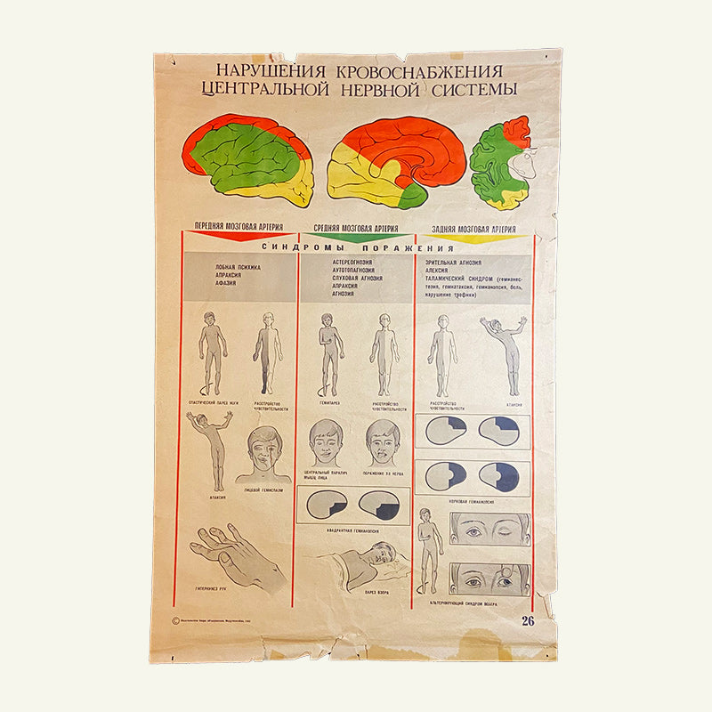 Brain blood supply disorders, Medical poster, Ukrainian SSR, 1981