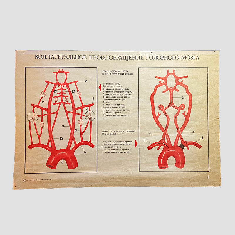 Collateral blood circulation of the brain, Medical poster, Ukrainian SSR, 1984