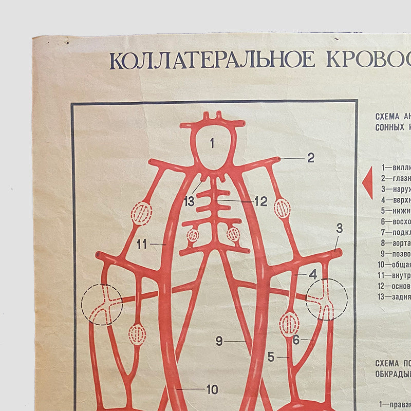 Collateral blood circulation of the brain, Medical poster, Ukrainian SSR, 1984