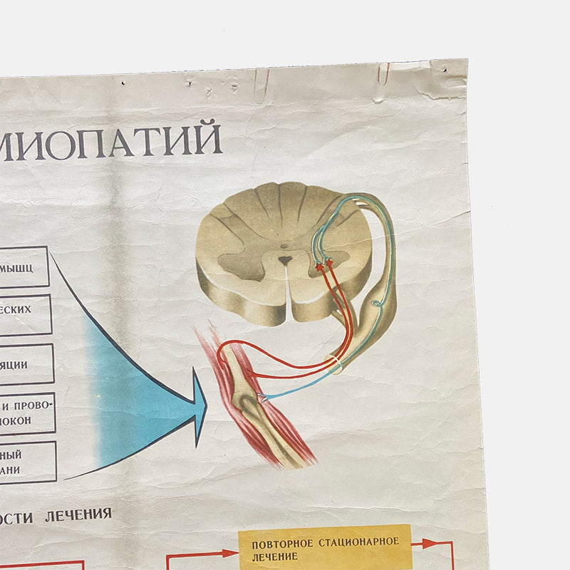 Treatment of meopathies, Medical poster, USSR (CCCP), 1983
