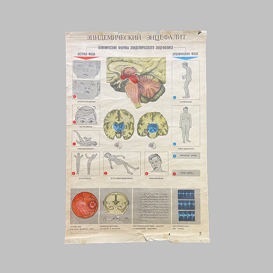Clinical forms of epidemic encephalitis, Medical poster, USSR (CCCP), 1981